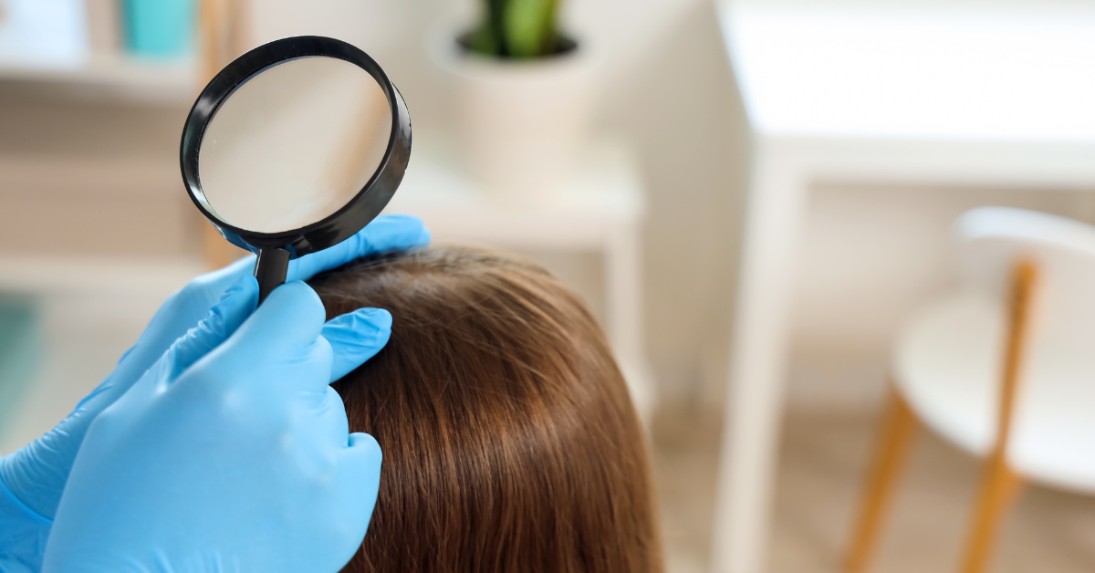 Close-up concept of nit shells attached to hair